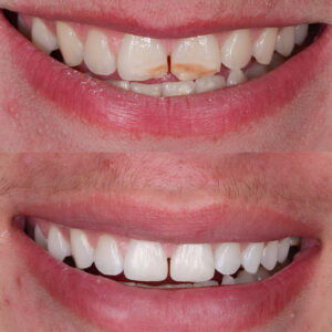 Esthétique Antérieure Ultra-conservatrice - 8 octobre 2026 - Le Mans