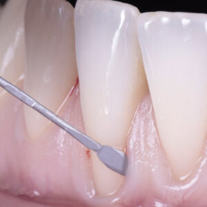 Guest / Parodontologie avec le Dr Maëva WERLE - 02 juillet 2026 - Le Mans