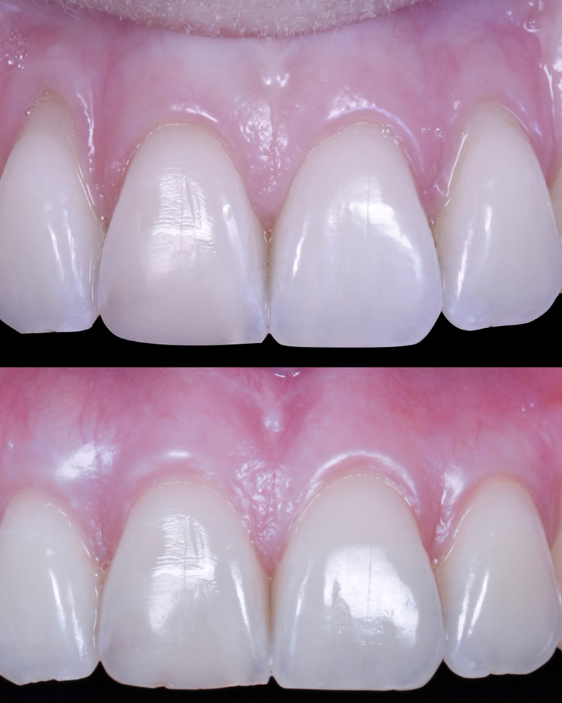 colibri-formation-dentaire-parodontologie-1