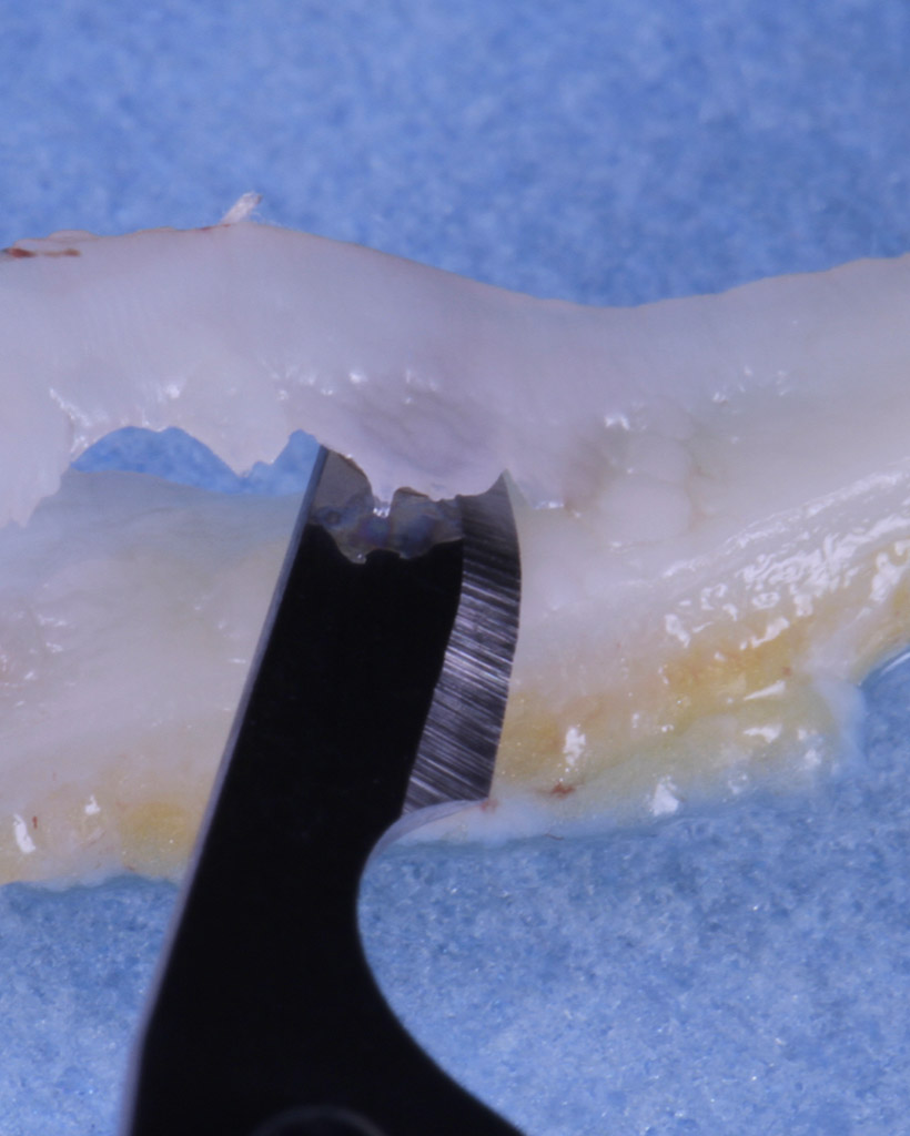 colibri-formation-dentaire-parodontologie-3